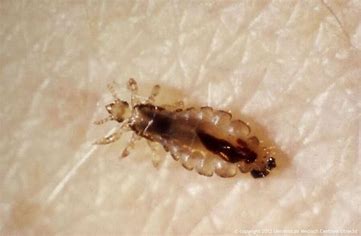 Understanding Lice: Causes and Prevention for Healthy Hair